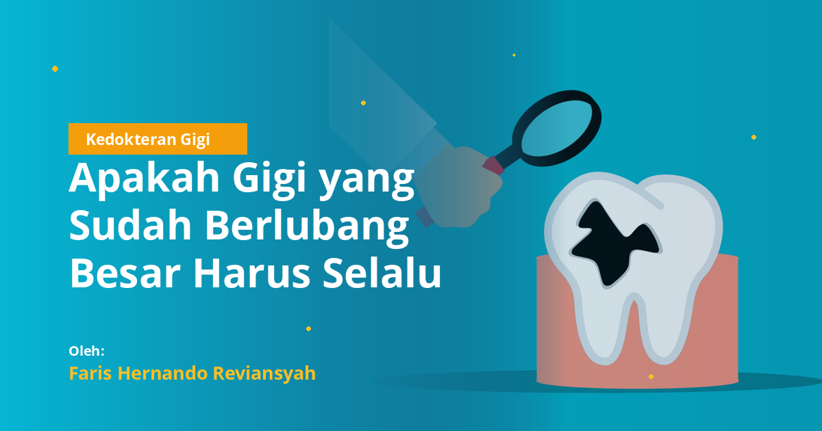 Apakah Gigi yang Sudah Berlubang Besar Harus Selalu Dicabut? Ini Penjelasan Dokter Gigi