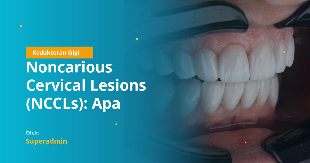 Noncarious Cervical Lesions (NCCLs): Apa Bedanya dan Bagaimana ...