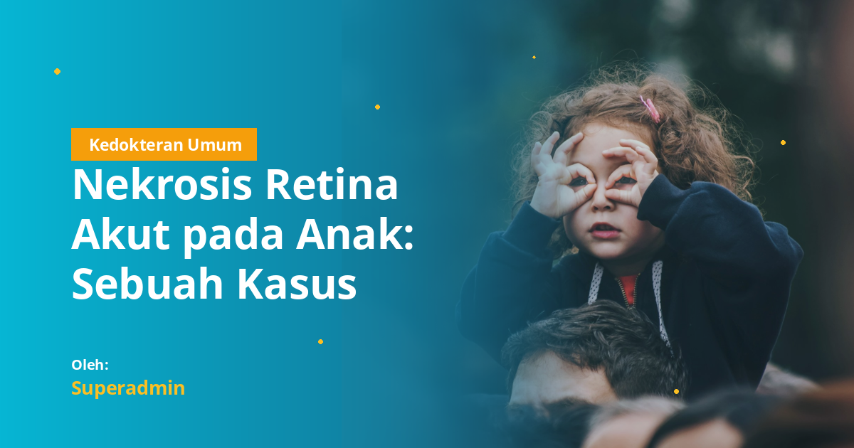 Nekrosis Retina Akut pada Anak: Sebuah Kasus Langka yang Menuntut Kewaspadaan Dini