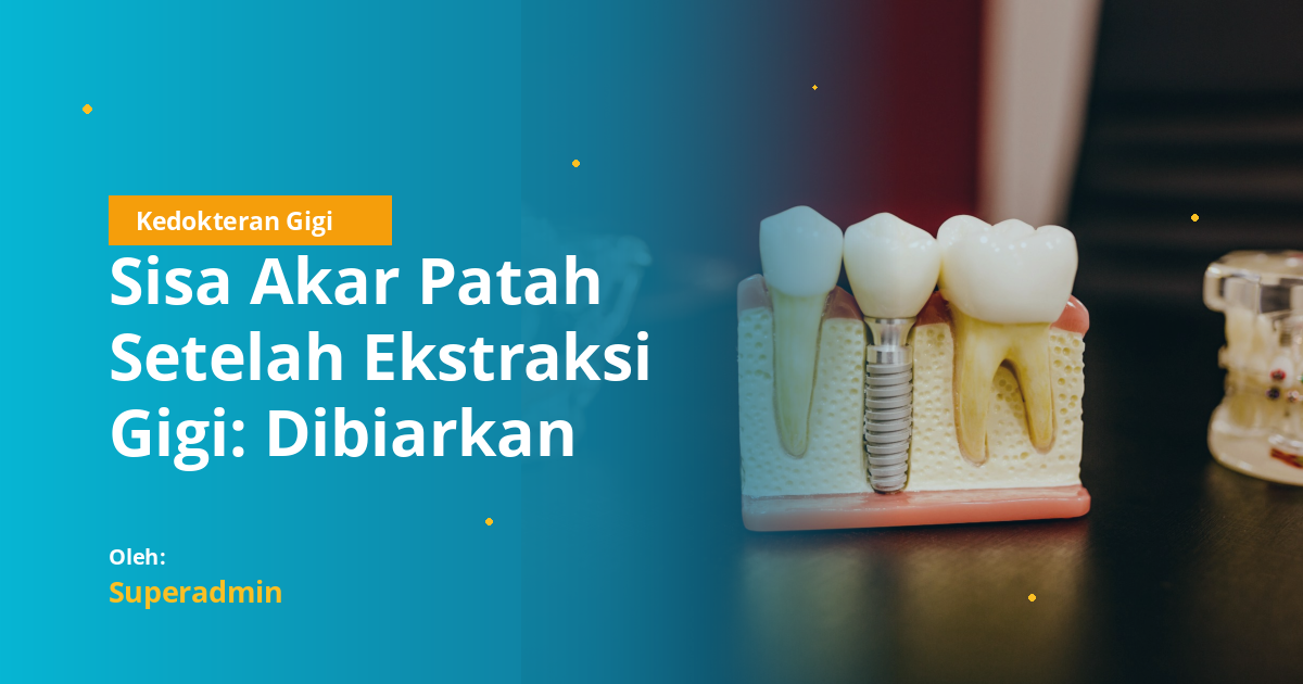 Sisa Akar Patah Setelah Ekstraksi Gigi: Dibiarkan atau Harus Dikeluarkan? Panduan Lengkap