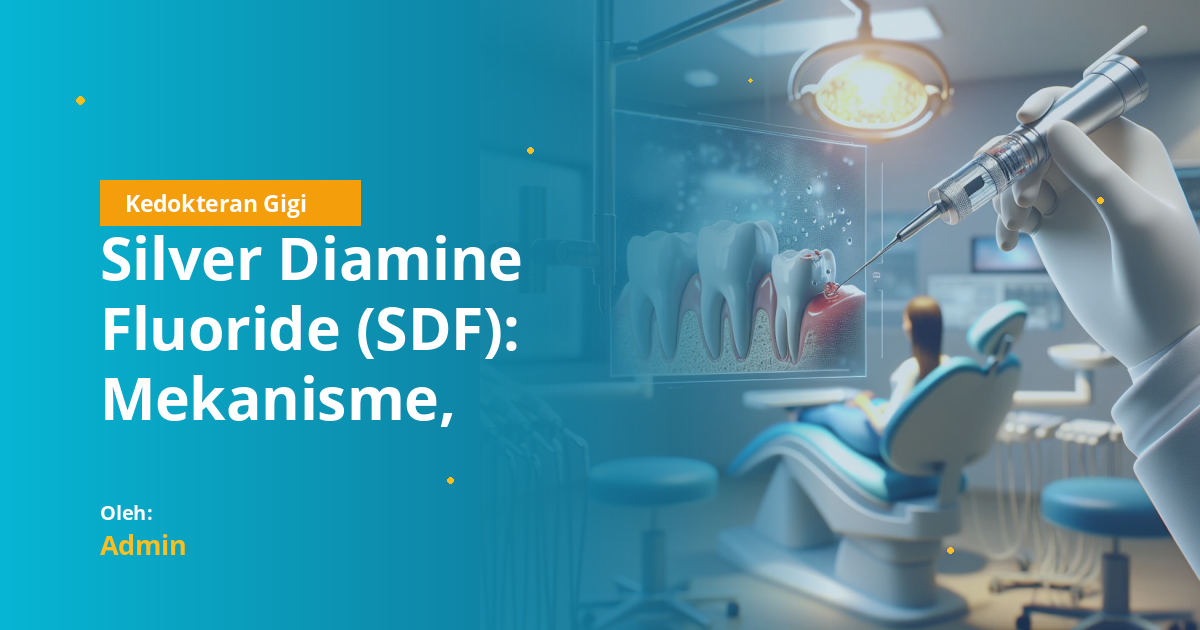 Silver Diamine Fluoride (SDF): Mekanisme, Indikasi, Prosedur, dan Perannya dalam Penanganan Karies untuk Mahasiswa Kedokteran Gigi