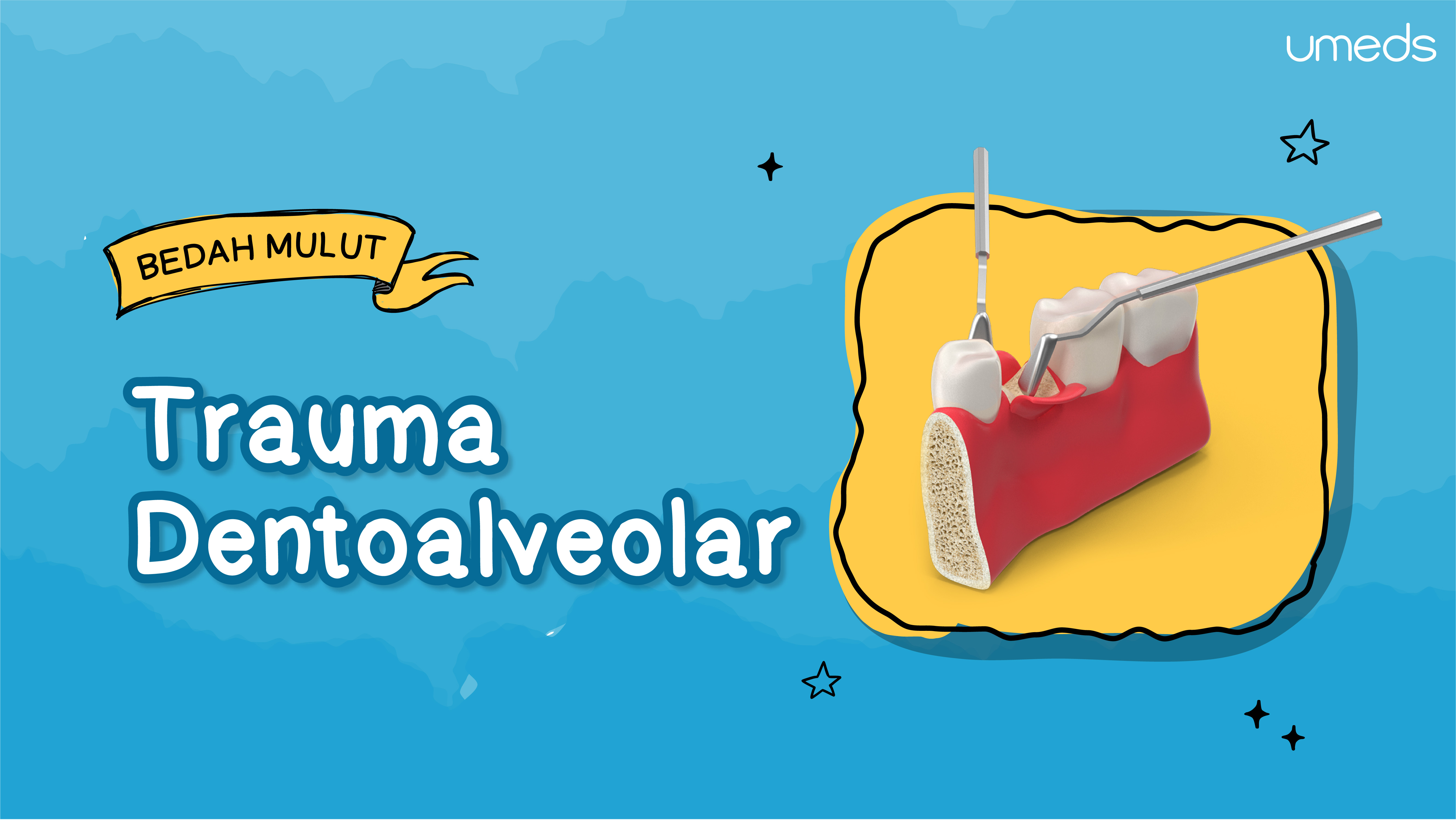 Trauma Dentoalveolar