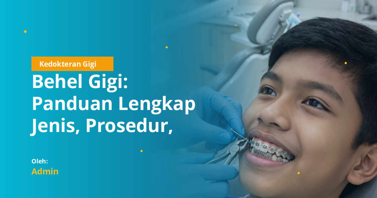 Behel Gigi: Panduan Lengkap Jenis, Prosedur, Biaya, dan Perawatan untuk Mahasiswa Kedokteran Gigi