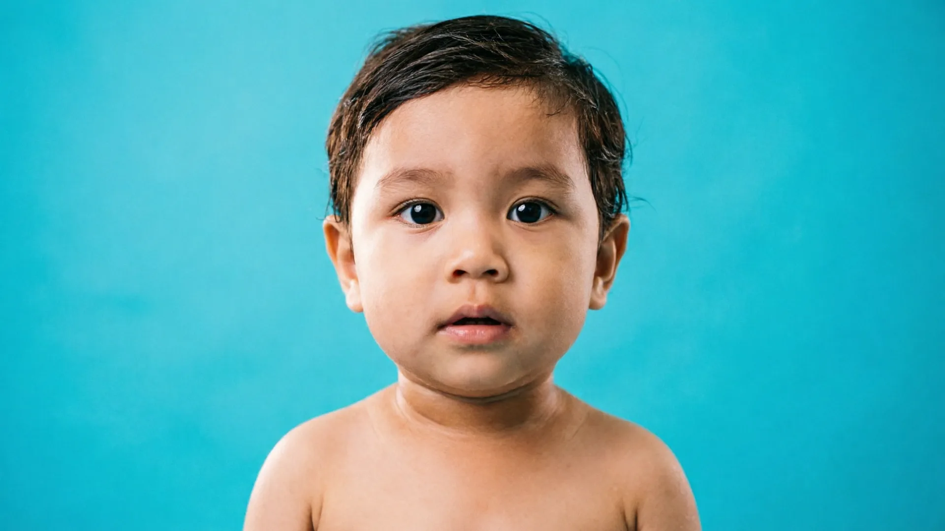 Hernia pada Anak