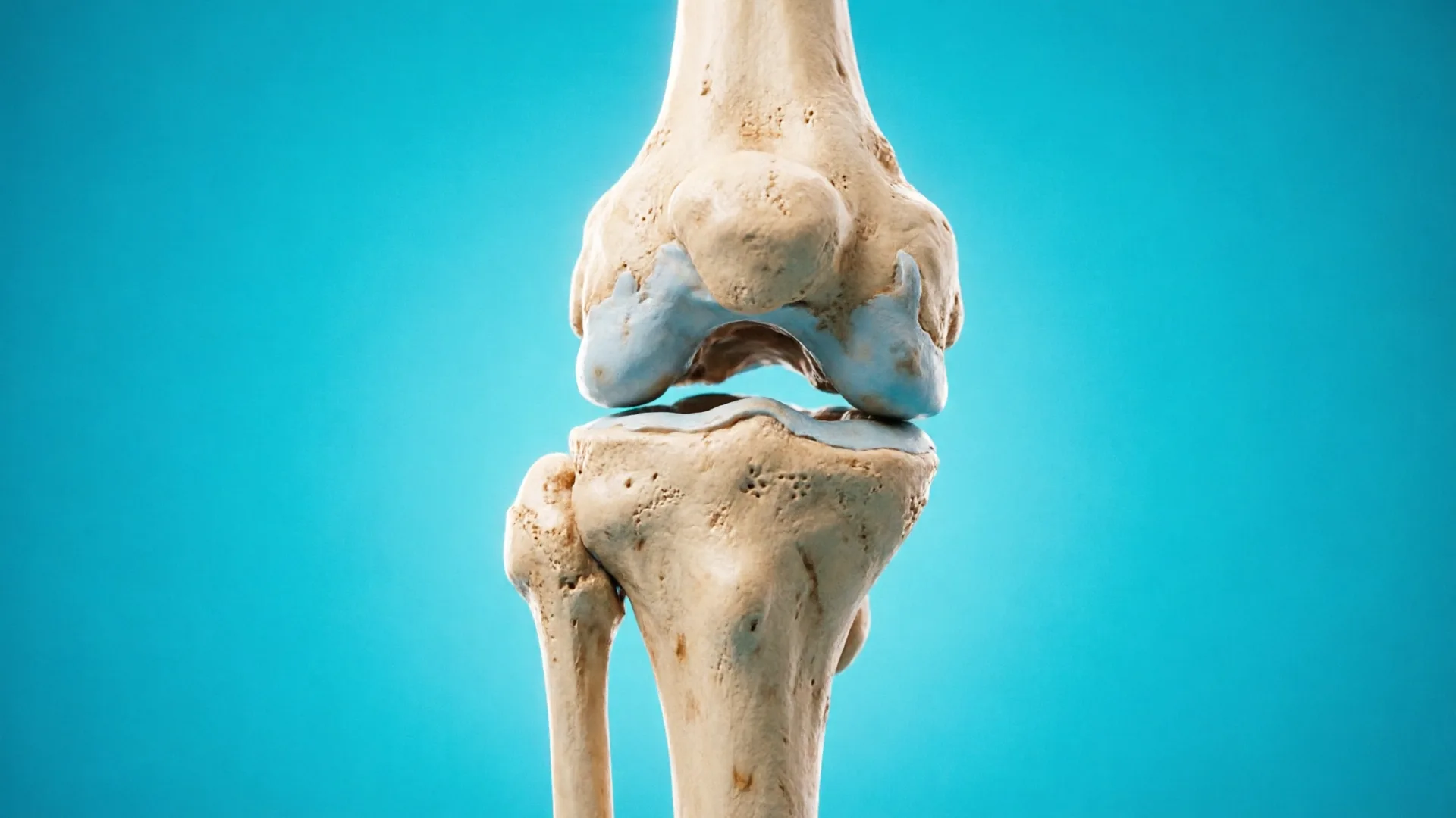 Penyakit Tulang Sendi dan Osteoporosis