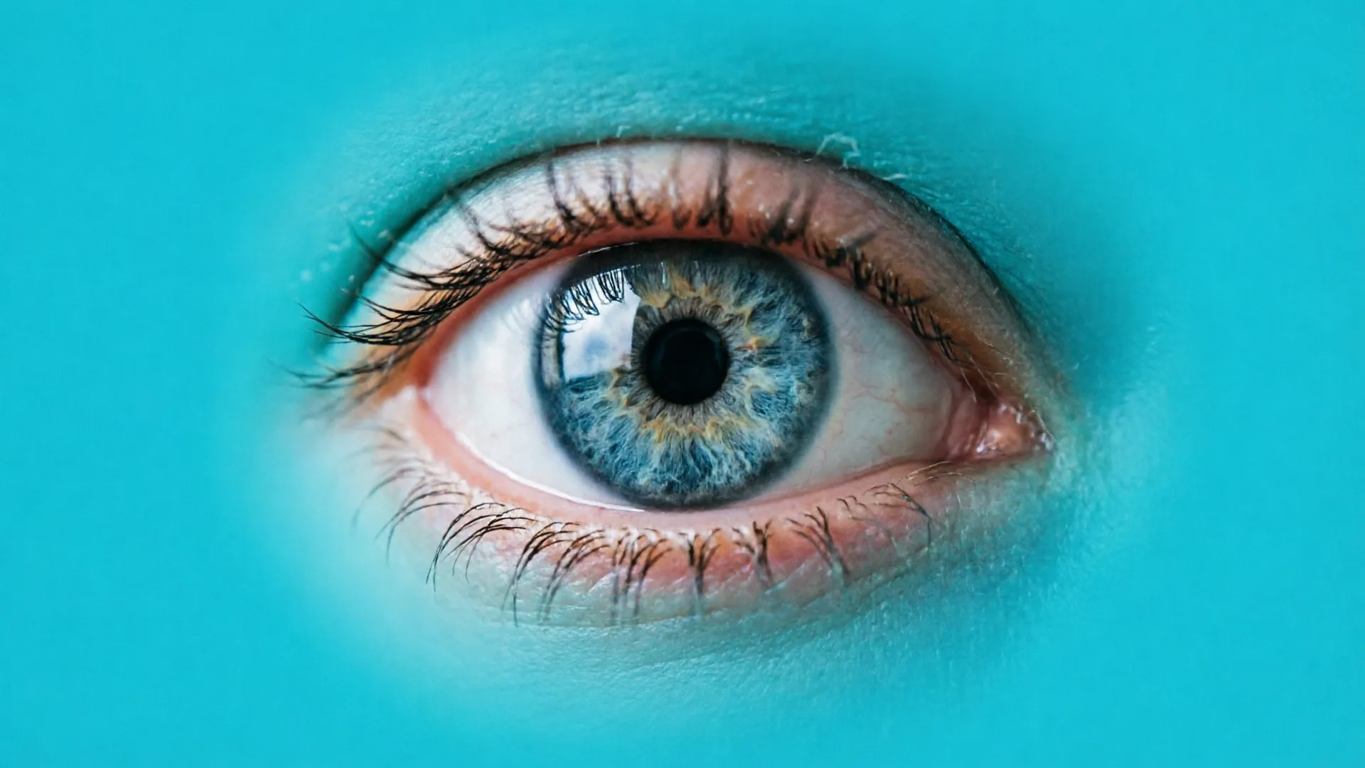 Myopia – Definisi, Etiologi, dan Manajemen