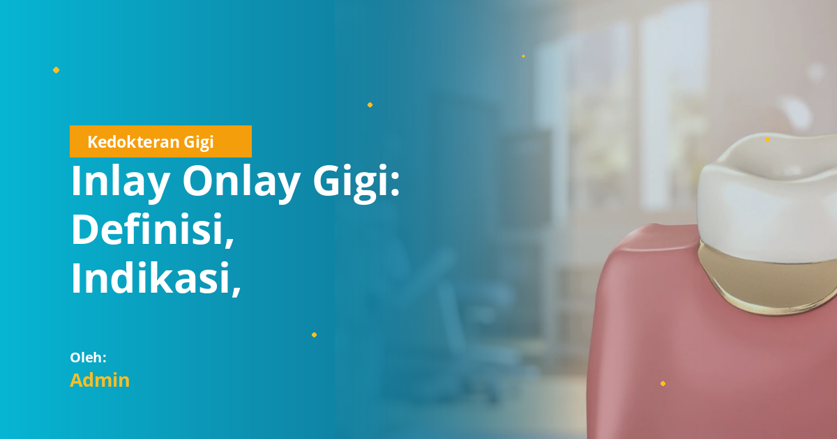 Inlay Onlay Gigi: Definisi, Indikasi, Prosedur, Bahan, dan Biaya untuk Mahasiswa Kedokteran Gigi