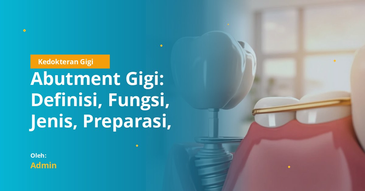 Abutment Gigi: Definisi, Fungsi, Jenis, Preparasi, dan Peran dalam Prostodonsia untuk Mahasiswa Kedokteran Gigi