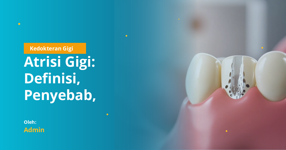 Atrisi Gigi: Definisi, Penyebab, Klasifikasi, Diagnosis, dan Penatalaksanaan Lengkap untuk Mahasiswa Kedokteran Gigi