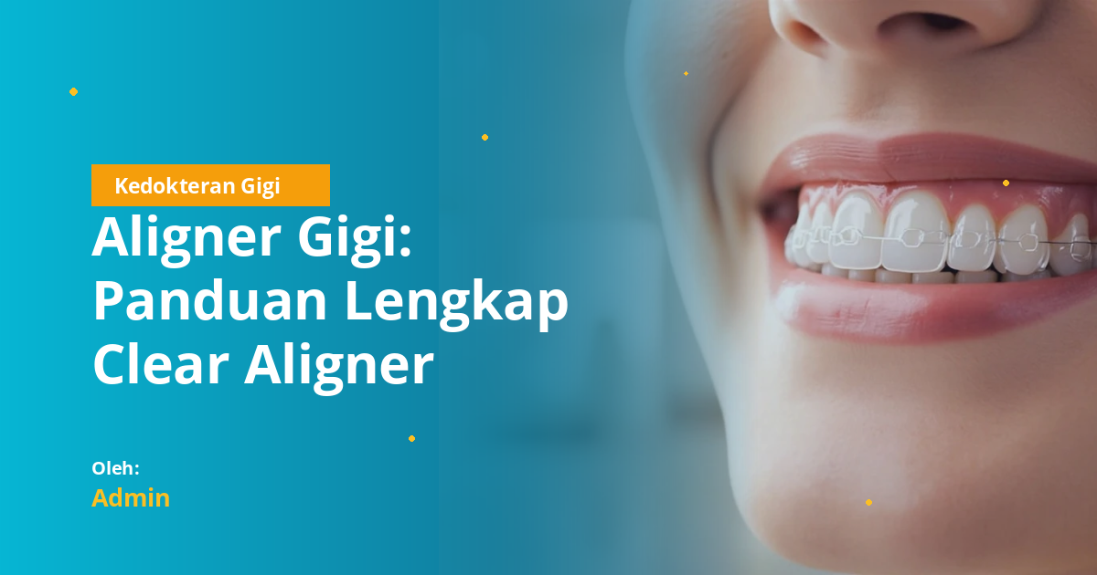 Aligner Gigi: Panduan Lengkap Clear Aligner Therapy, Indikasi, Biomekanik, dan Perawatan untuk Mahasiswa Kedokteran Gigi