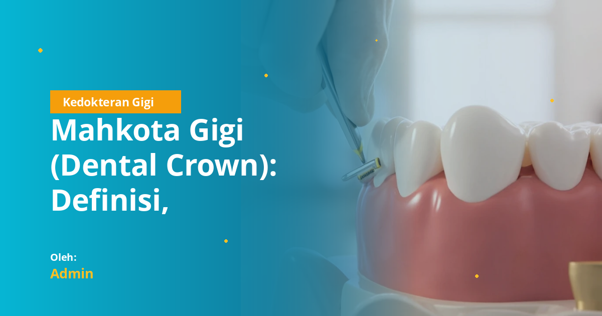 Mahkota Gigi (Dental Crown): Definisi, Indikasi, Jenis Bahan, Preparasi, dan Prosedur Klinis untuk Mahasiswa Kedokteran Gigi