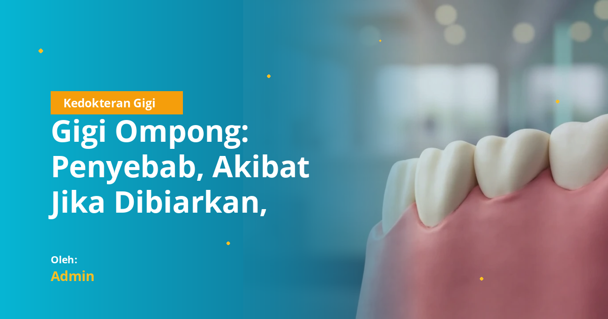 Gigi Ompong: Penyebab, Akibat Jika Dibiarkan, Opsi Perawatan, dan Pencegahan untuk Mahasiswa Kedokteran Gigi