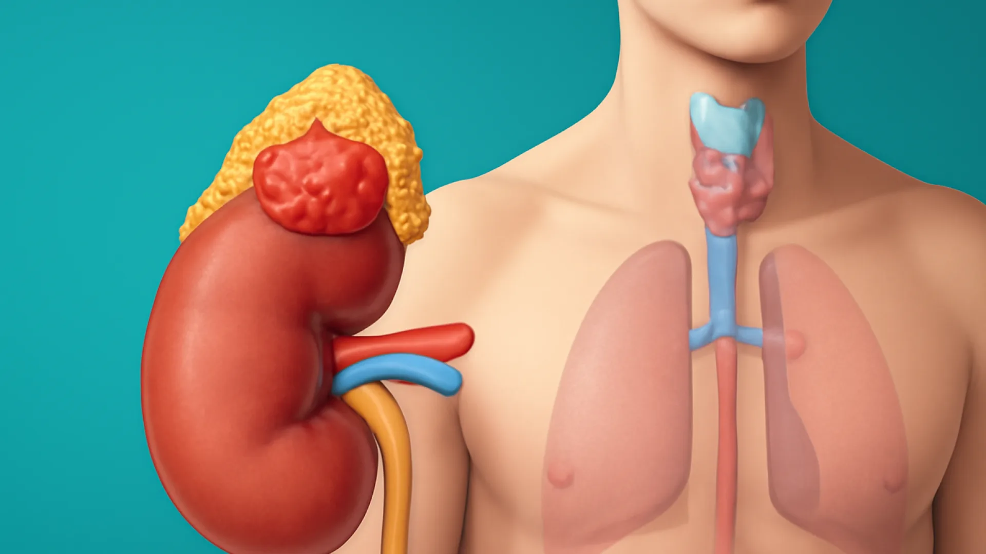 Gangguan Adrenal