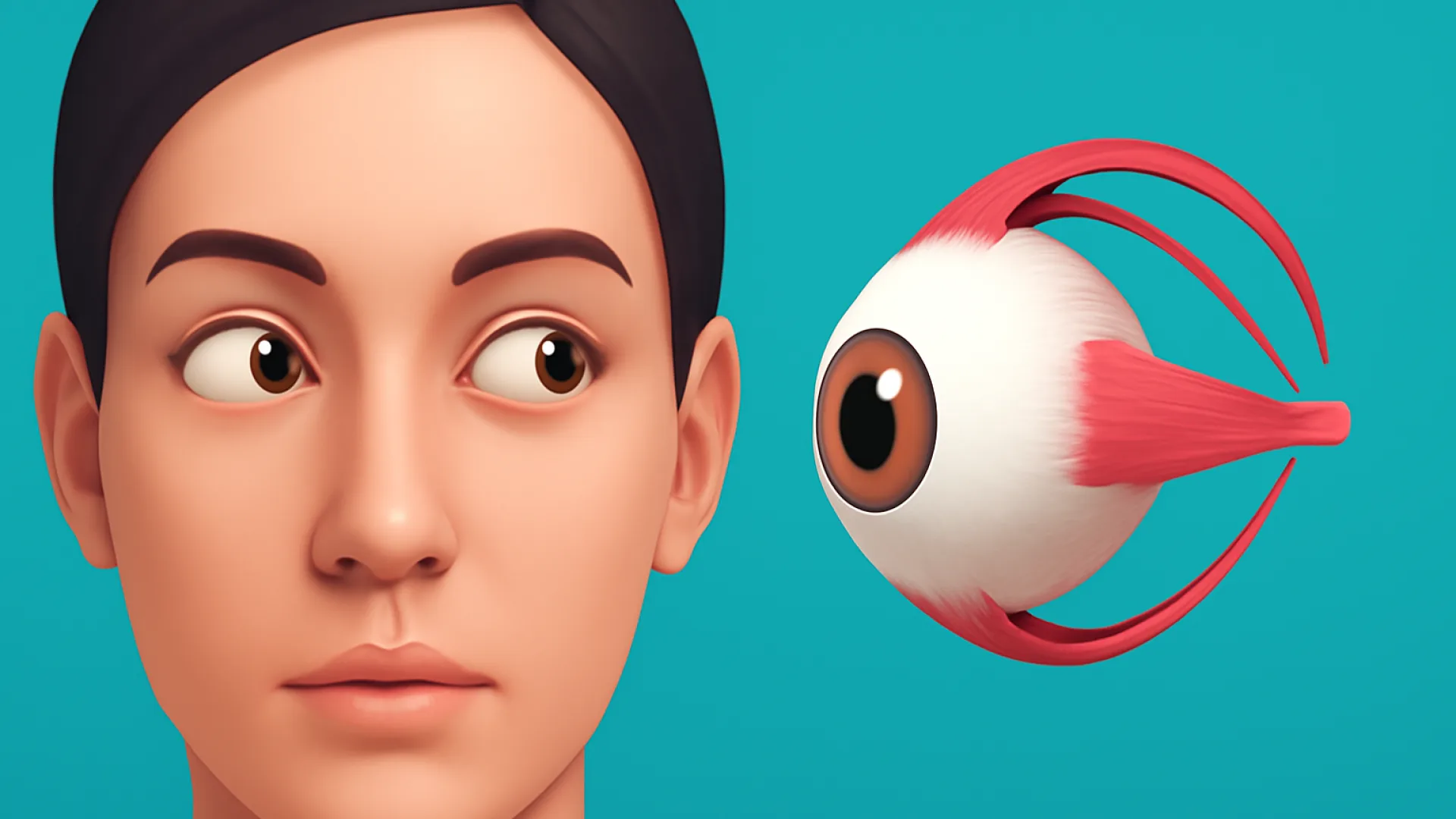 Strabismus