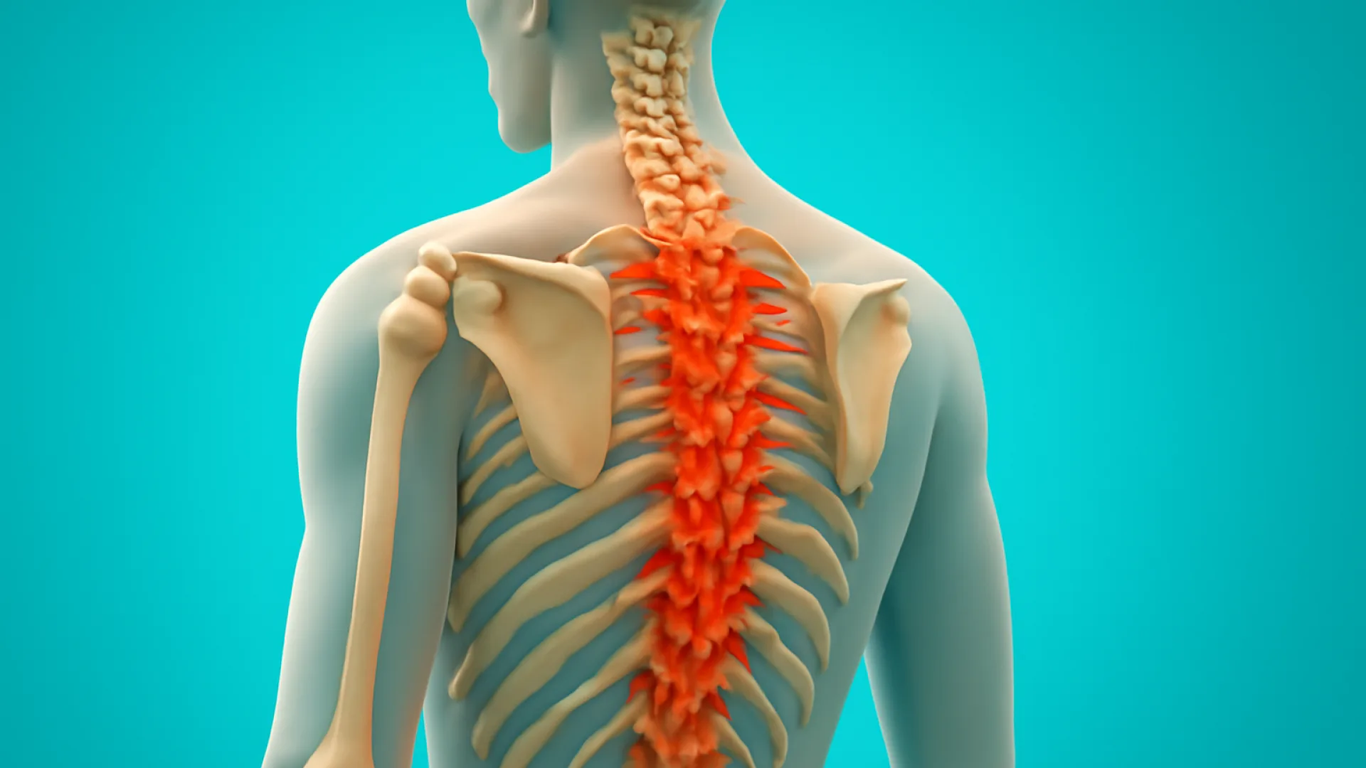 Ankylosing Spondylitis / TB