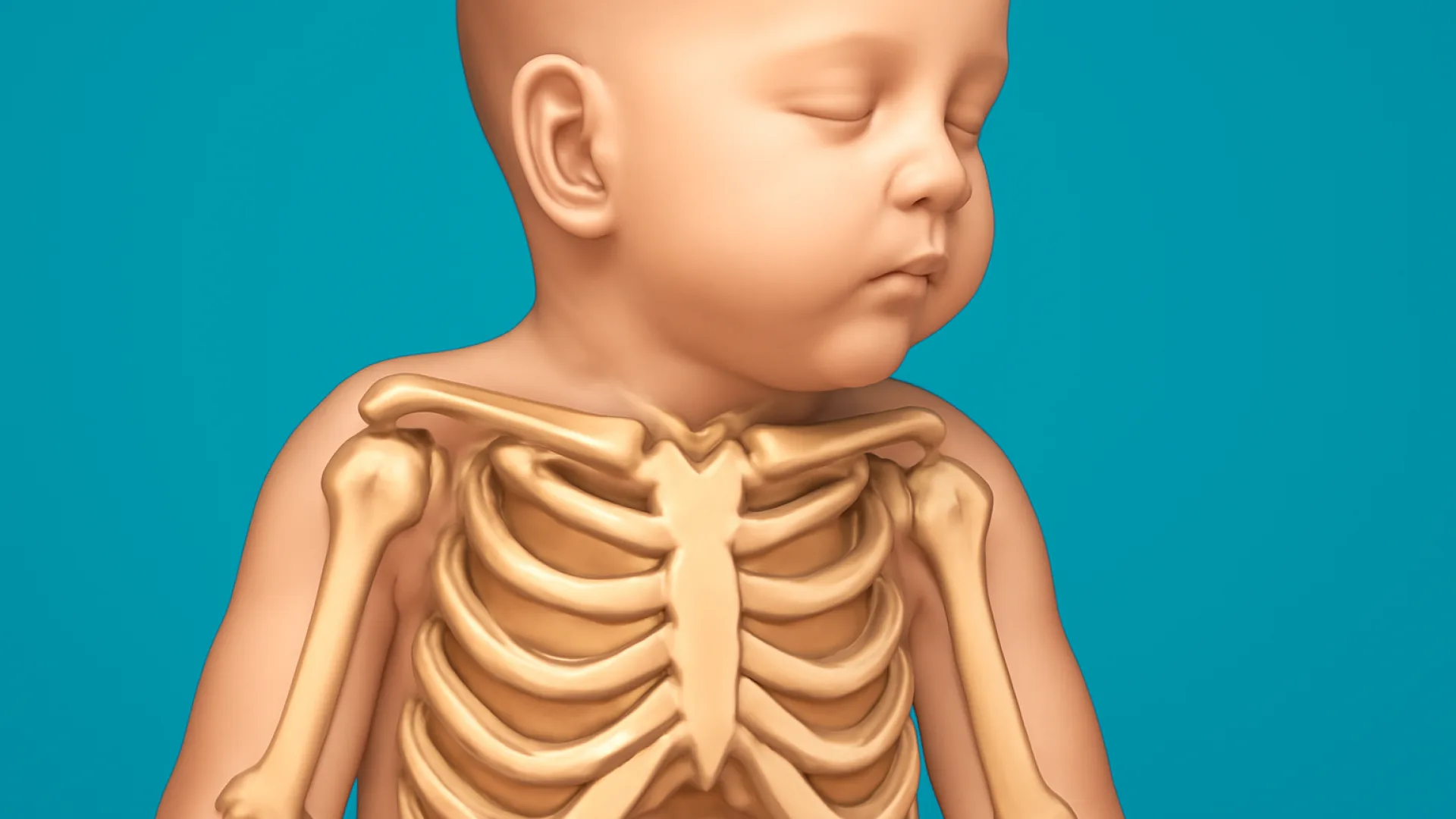 Kongenital (muskuloskeletal)