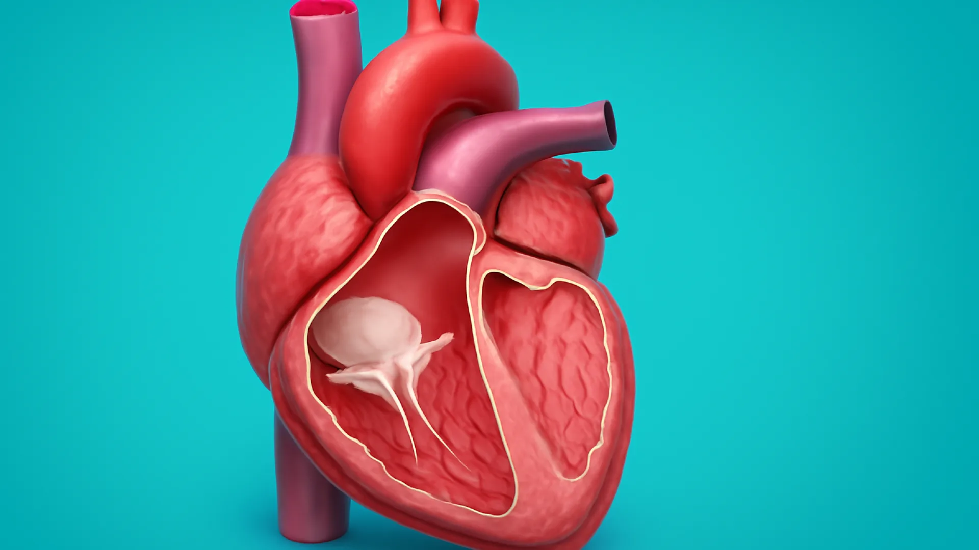 Stenosis Trikuspid / Pulmonal