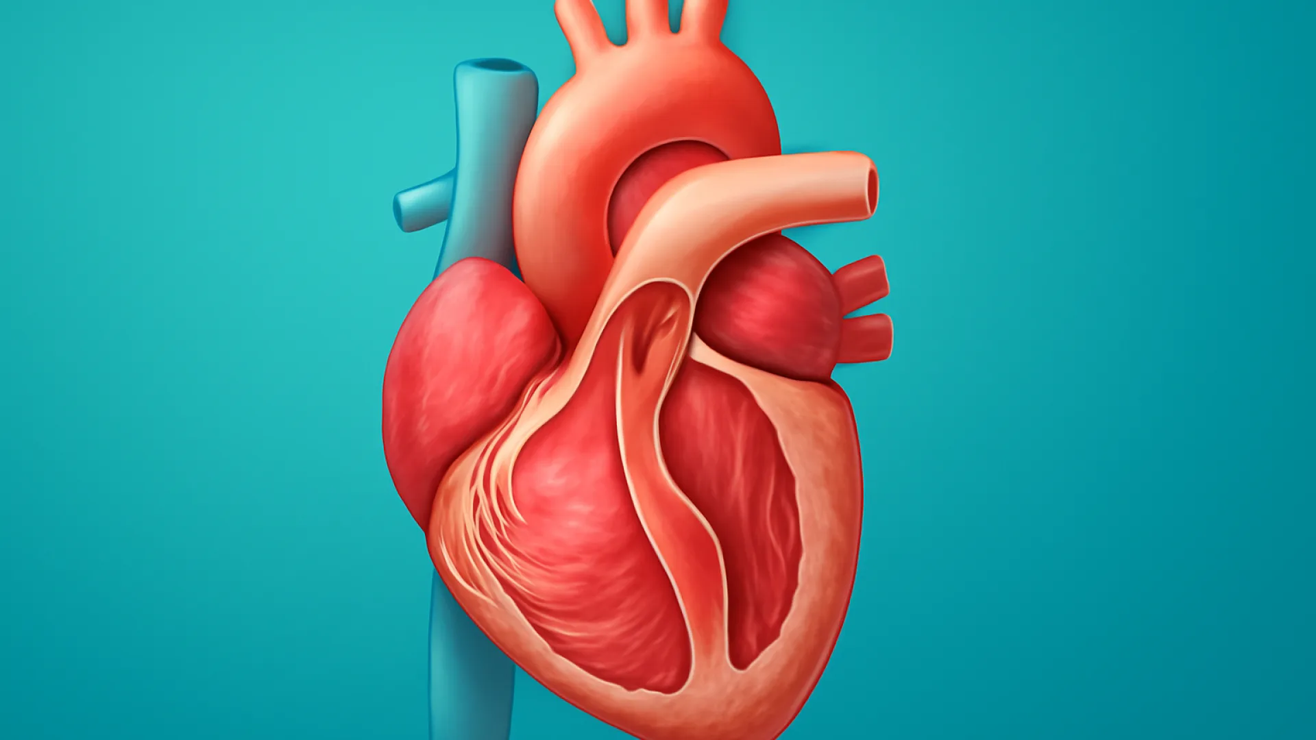 Regurgitasi Aorta