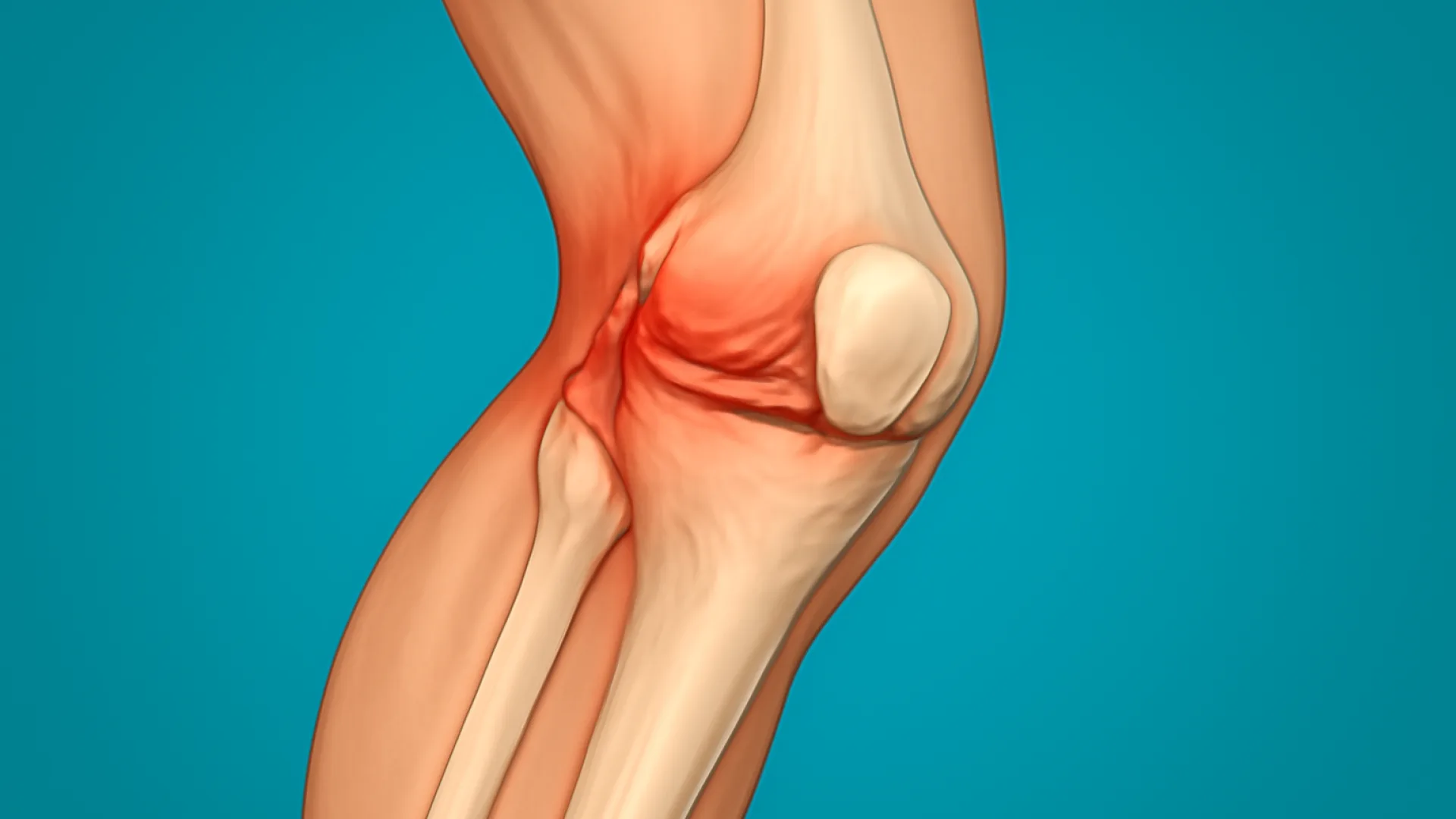 Tabel: Cedera Lutut/Ankle