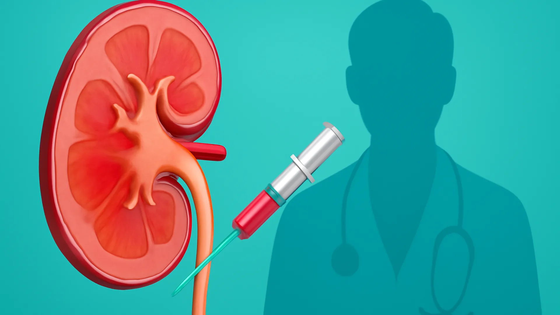 AKI (Acute Kidney Injury)