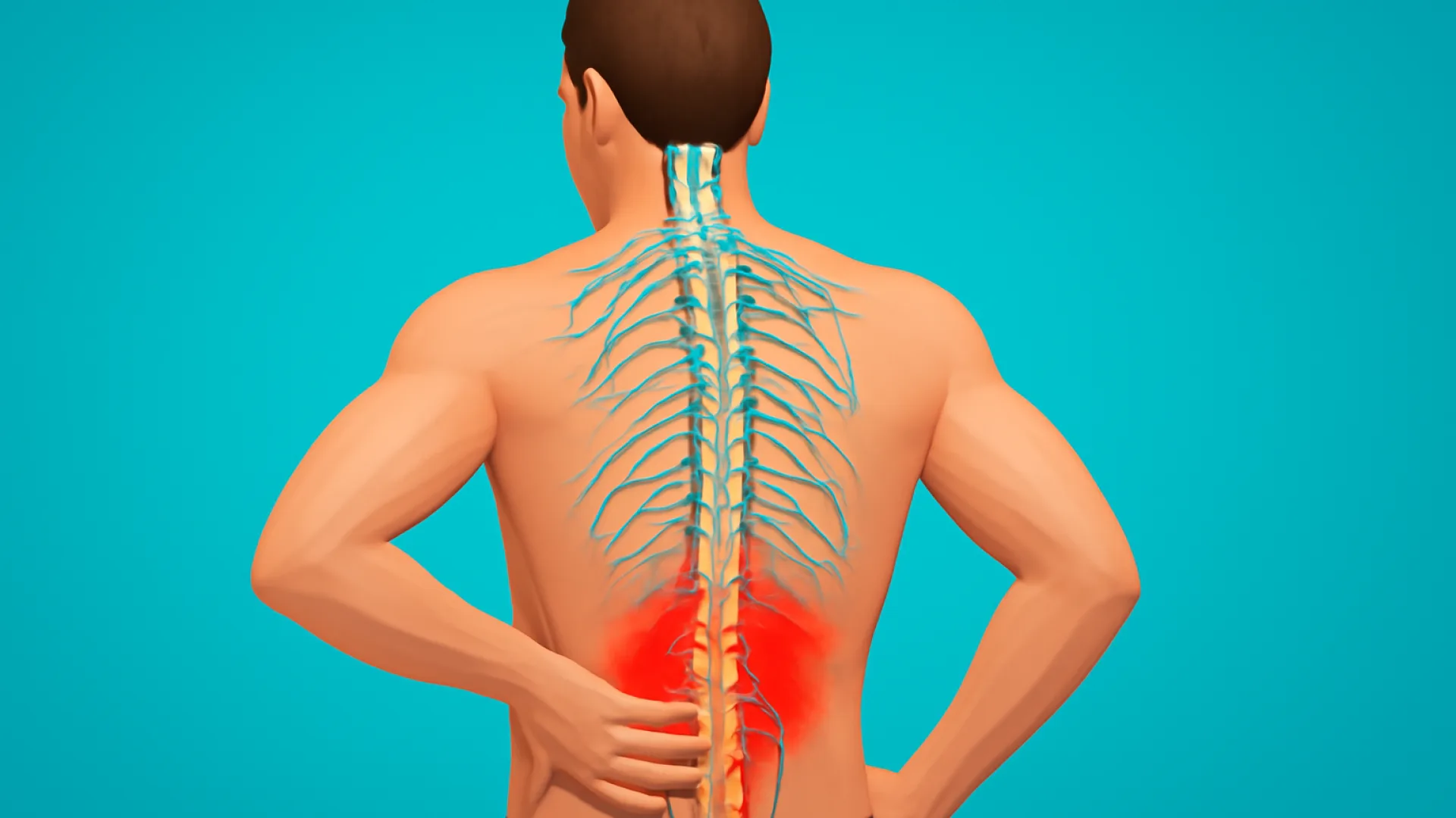 Nyeri Punggung (neuro)