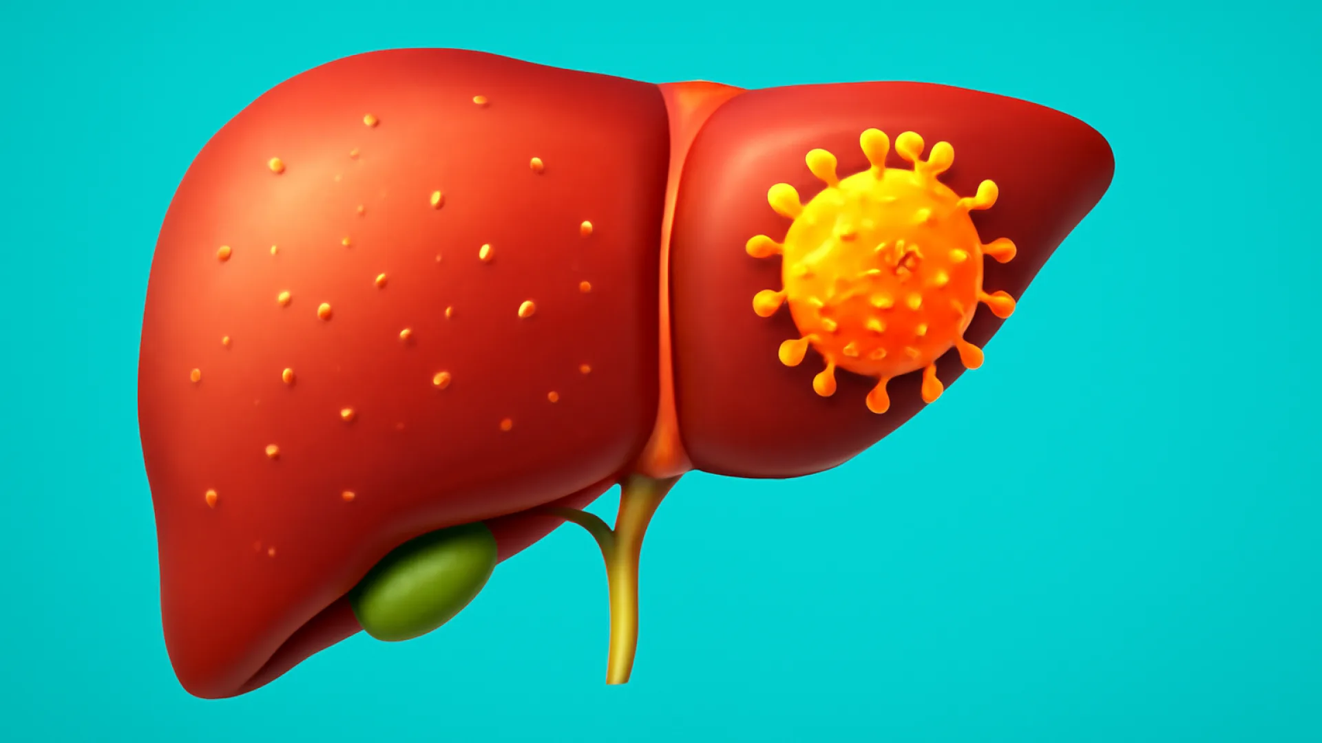 Hepatitis Viral