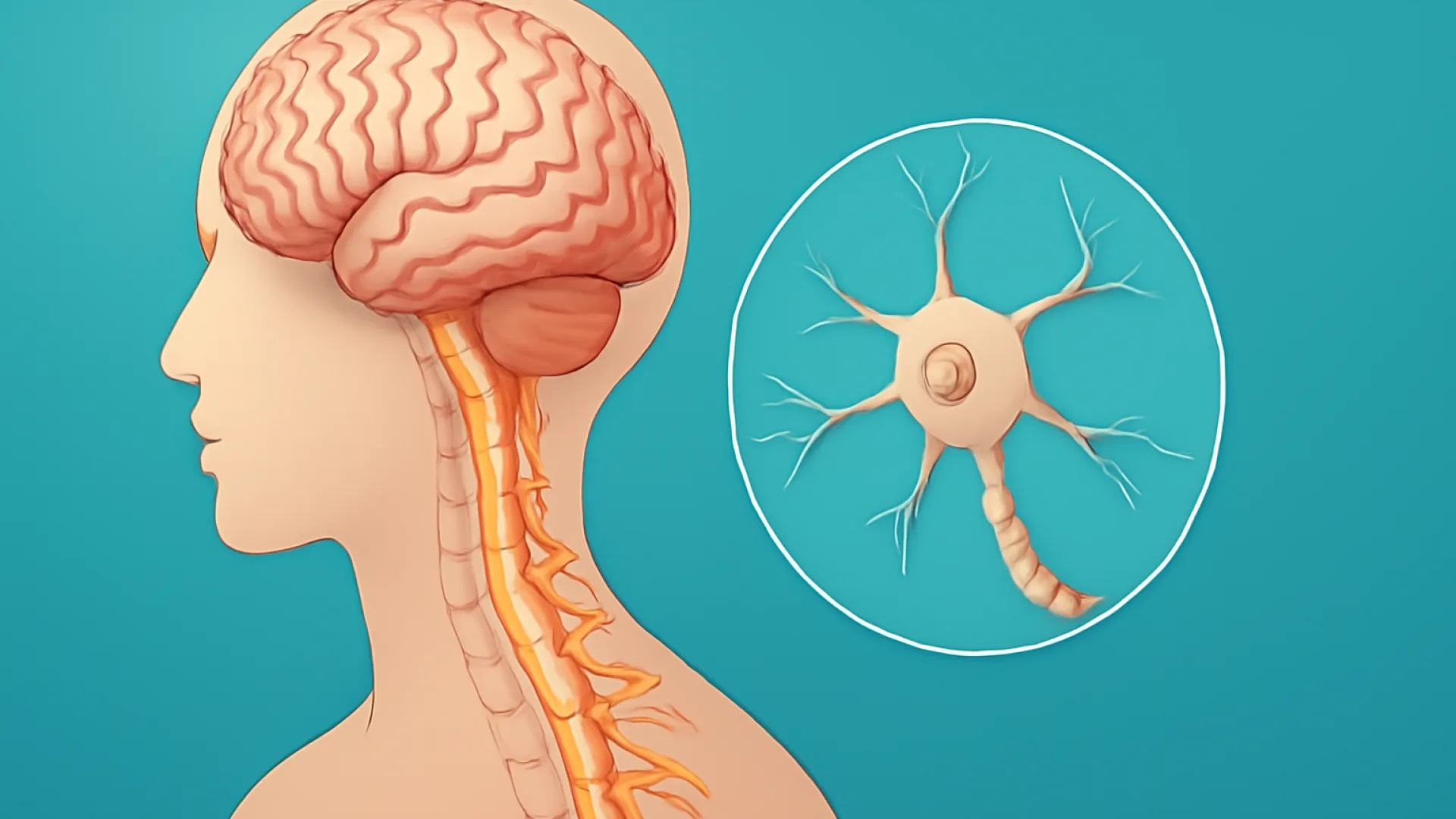 Multiple Sclerosis