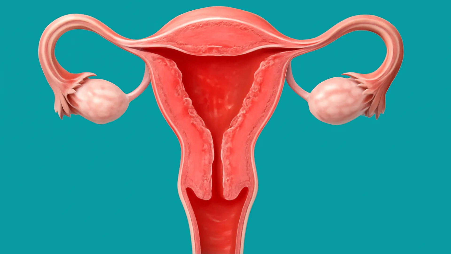 Endometritis / Sisa Plasenta