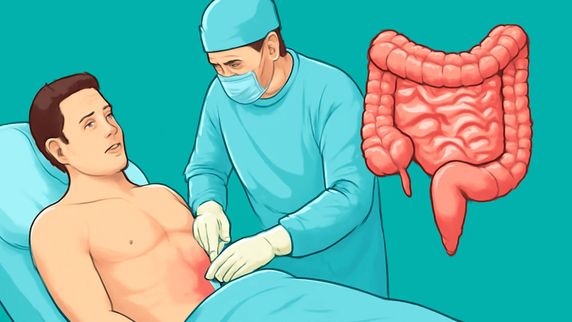 Tabel Akut Abdomen